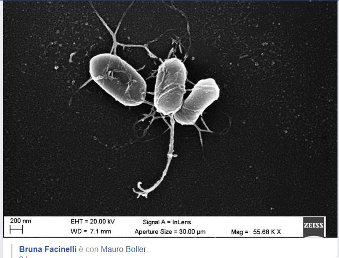 Listeria monocytogenes. microscopio elettronico